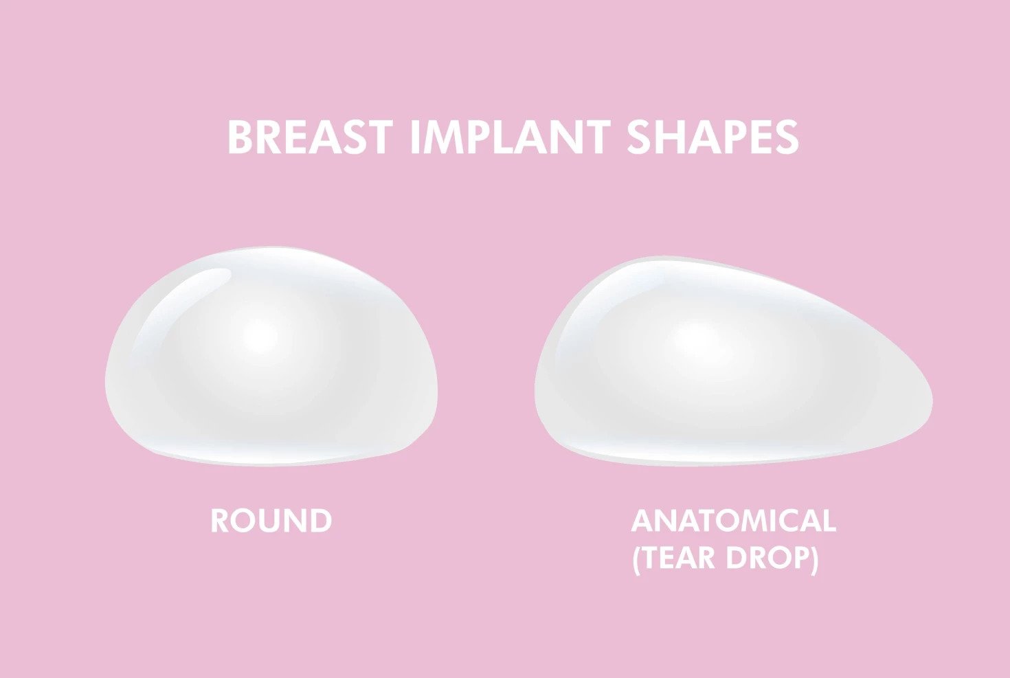 Breast Implants/Round Breasts - Concept - v1.0 - Reviewed by xrxlkool