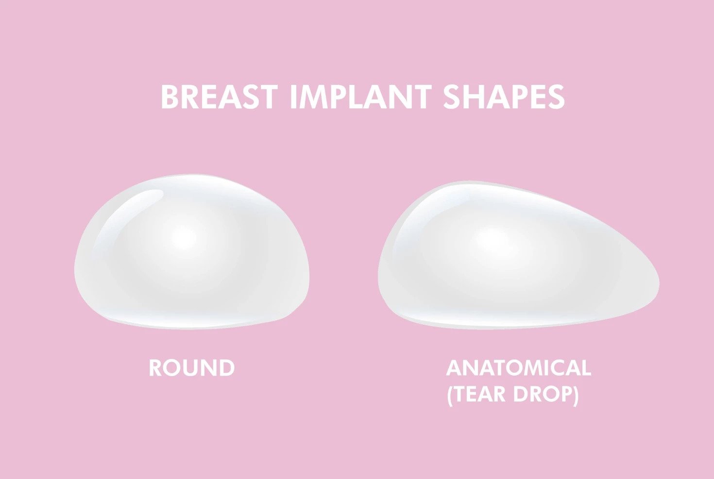 Round and Anatomical Breast Implants