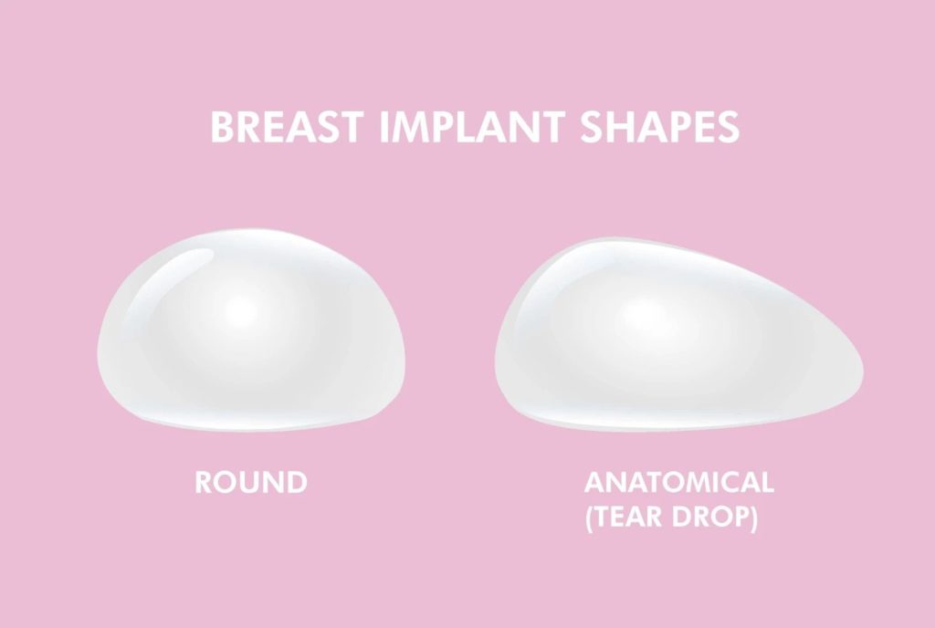 Round and Anatomical Breast Implants